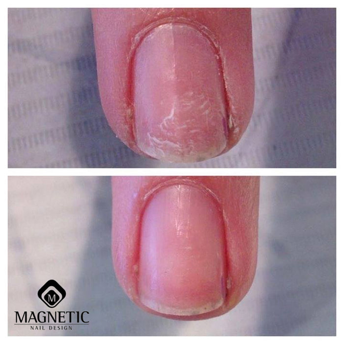 Seal & Protect Solution · Magnetic*